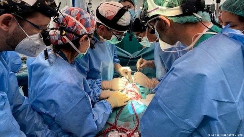 भारतः अंगदान करने वालों की कमी क्यों?