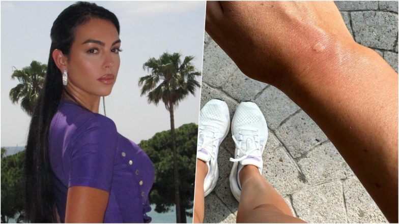 Bee Stings Cristiano Ronaldo's Girlfriend Georgina Rodriguez:&nbsp;फैमिली डे आउट पर क्रिस्टियानो रोनाल्डो की गर्लफ्रेंड जॉर्जीना रोड्रिग्ज को मधुमक्खी ने मारा डंक,&nbsp;देखें&nbsp;बेटे&nbsp;के प्री-बर्थडे सेलिब्रेशन की तस्वीरें
