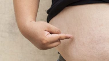 Obesity: नाम बदलने से इससे जुड़ा कलंक रातों-रात ठीक नहीं हो जाएगा, दरअसल क्या करें