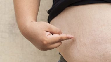 Obesity: मोटापा से कोविड से उबरने में लगता है अधिक समय