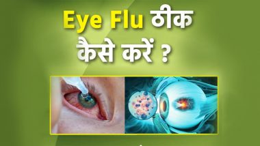 Eye Flu Home Care: आई फ्लू से खुद को कैसे रखें सुरक्षित, बचाव के लिए अपनाएं ये सेफ्टी टिप्स