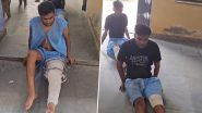 UP Dupatta-Pulling Case: छेड़छाड़ के दौरान दुपट्टा खींचने से सड़क पर गिरी लड़की की मौत मामले में गिरफ्तार आरोपियों को लेकर दावा, पुलिस द्वारा दंडित किये जाने पर पैर टूटने पर चढ़ा प्लास्टर? जानें वायरल वीडियो का सच