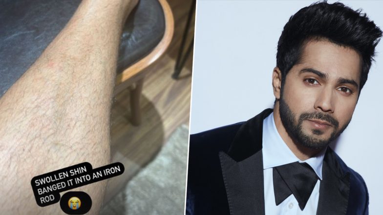 Varun Dhawan Injured: वरुण धवन को VD 18 शूटिंग के दौरान लगी चोट, सोशल मीडिया पर शेयर की तस्वीर (View Pic)