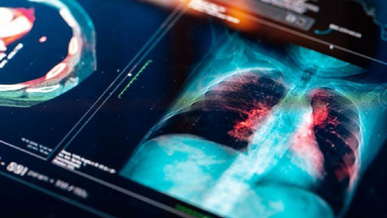 Mysterious White Lung Syndrome: अमेरिका समेत दुनियाभर में फैल रहा रहस्यमय व्हाइट लंग सिंड्रोम, बच्चों से भरे हुए हैं अस्पताल