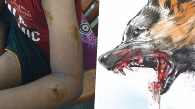 Boy Bitten By Pet Dog:  चेन्नई में  9 साल के बच्चे पर पालतू कुत्ते ने किया हमला, मालिक के खिलाफ केस दर्ज