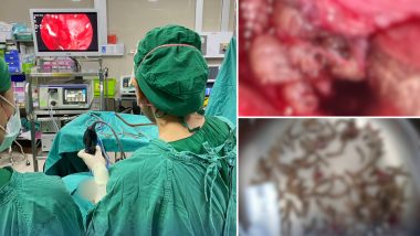 Maggots in Woman’s Nostrils: बंद नाक से परेशान थी महिला, डॉक्टर ने की जांच तो अंदर दिखा सैकड़ों कीडों का आशियाना