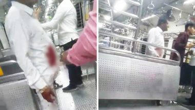 VIDEO: मुंबई लोकल ट्रेन में मर्डर! हंसी-ठिठोली पर भड़के युवकों ने किसान की कर दी हत्या, हमले का वीडियो वायरल
