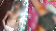 Pitbull Dog Attack Minor in Noida: पिटबुल डॉग का एक बच्चे पर जानलेवा हमला, यूपी पुलिस ने किया मालिक को गिरफ्तार ( Watch Videos)