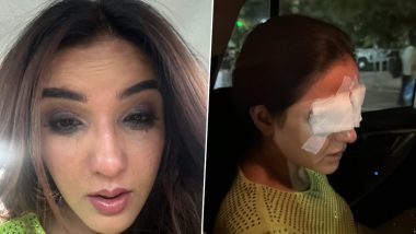 Jasmin Bhasin suffers corneal damage: लेंस की दुर्घटना के बाद कॉर्नियल डैमज से जूझ रही हैं Jasmin Bhasin