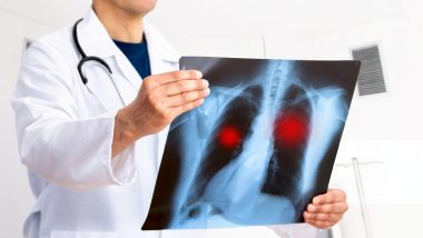 Lung Cancer Hits Non-Smokers: सिगरेट न पीने वालों को भी फेफड़ों के कैंसर खतरा, भारत में ऐसे मरीजों की औसत आयु कम