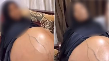 Viral Video: टेक्सास की महिला ने गर्भ में 18 बच्चों के पलने का किया दावा, फूले पेट की सच्चाई जानकर उड़े लोगों के होश