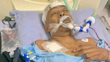 Bangladesh Violence: चिन्मय कृष्ण दास के वकील रमन रॉय पर जानलेवा हमला, ICU में भर्ती