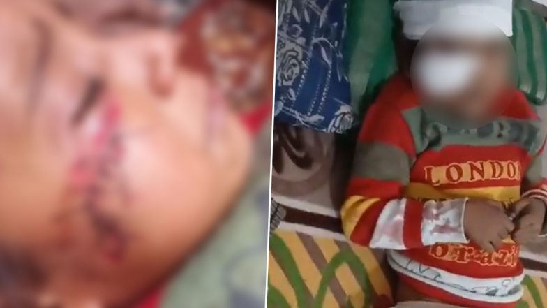 VIDEO: घर के बाहर खेल रहे बच्चे पर कुत्तों के झुंड ने किया हमला, बुरी तरह से किया घायल, मासूम के चेहरे में लगे टांके, अलीगढ से वीडियो आया सामने