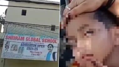The Teacher Beat the Child: होमवर्क नहीं करने पर 6 साल के बच्चे को टीचर ने जमकर पीटा, गाल पर निशान देखकर परिजनों को पता चली सच्चाई, ग्वालियर की स्कूल का मामला (Watch Video)