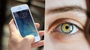 Smartphone Vision Syndrome: क्या है स्मार्टफोन विजन सिंड्रोम? जानें इसके होने के कारण, लक्षण और इलाज; कैसे बचाएं अपनी अनमोल आंखें