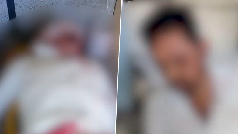 Indore Shocker: दो युवकों के बीच हुई जमकर मारपीट, गुस्से में एक ने दुसरे का कान चबाकर कर दिया अलग, इंदौर की भयावह घटना
