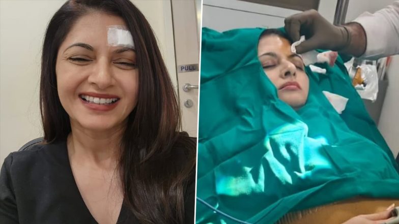 Bhagyashree Suffers a Serious Forehead Injury: पिकलबॉल खेलते वक्त भाग्यश्री के माथे पर लगी गहरी चोट, सर्जरी के बाद 13 टांके