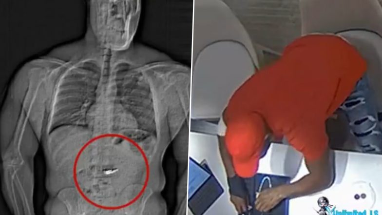 Viral Video: अमेरिका में चोर ने गिरफ्तारी से बचने के लिए चोरी के टिफ़नी एंड कंपनी के 6.7 करोड़ रुपये के डायमंड इयरिंग निगले, एक्स-रे में उसके पाचन तंत्र में दिखे हीरे