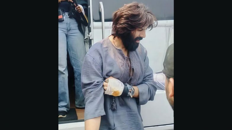Kartik Aaryan Injured: सेट पर घायल हुए कार्तिक आर्यन, फैंस ने की जल्द ठीक होने की दुआ