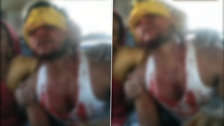 Raebareli Shocker: रायबरेली जिले में दबंगों ने किया घर पर हमला, शख्स को लाठी डंडो से पीटकर किया लहुलुहान