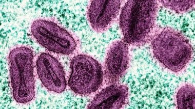 Zambia Mpox Virus: जाम्बिया में एमपॉक्स से दूसरी मौत की पुष्टि, मामले बढ़कर 49 हुए