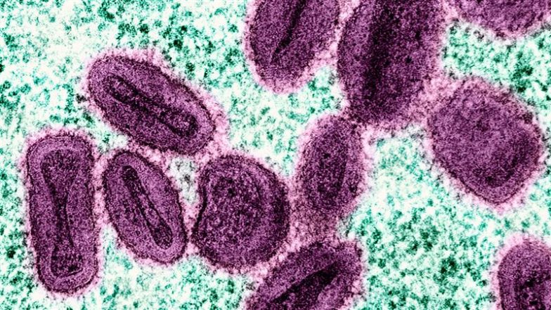 Uganda Mpox Case: युगांडा में एमपॉक्स से संक्रमित के मामले 8000 के पार, 50 मौतें दर्ज