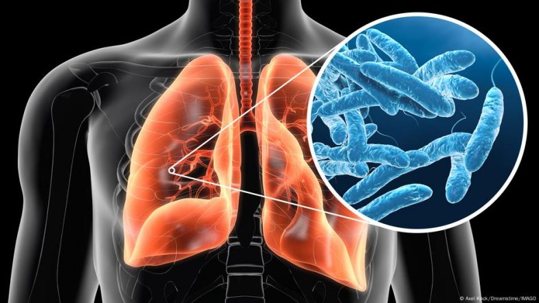 क्या है बर्लिन के कुछ किरायेदारों में फैली ‘लेज्योनेयर बीमारी’