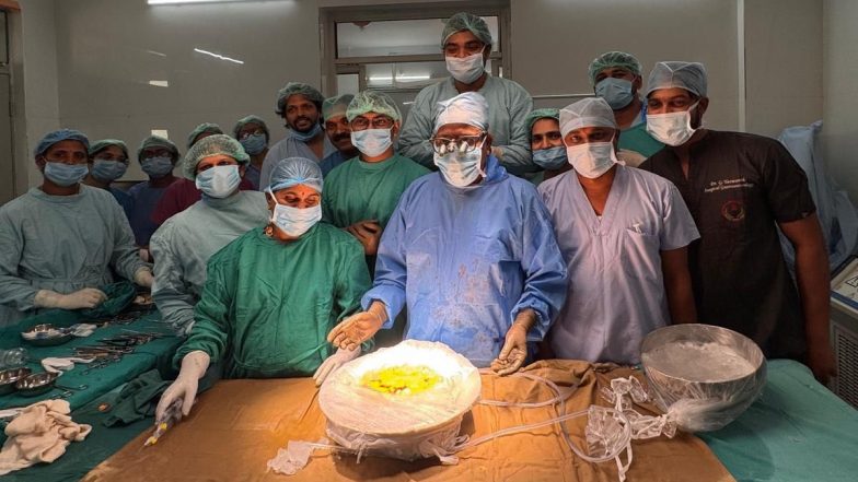 Intestine Transplant in Hyderabad: उस्मानिया जनरल अस्पताल के डॉक्टरों ने तेलंगाना का पहला कैडेवरिक छोटी आंत का सफलतापूर्वक प्रत्यारोपण किया (देखें तस्वीर)
