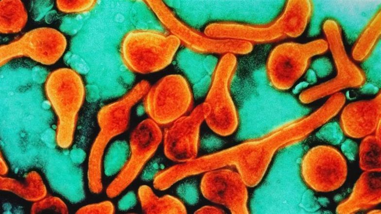 रूस में फैल रहा COVID जैसा रहस्यमयी वायरस? खून की उल्टियां कर रहे लोग; जानें हेल्थ एजेंसी ने क्या कहा
