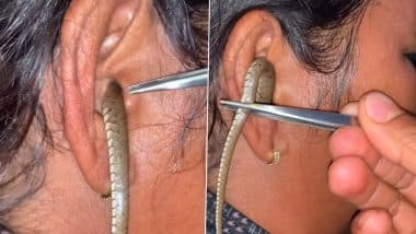 Shocking Video: महिला के कान में घुसा सांप, चिमटे से पूंछ पकड़कर उसे बाहर निकालने की कोशिश करता दिखा शख्स, लेकिन...