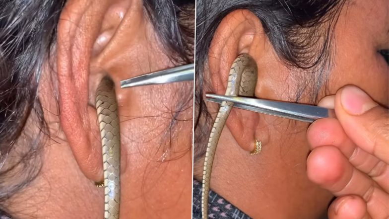 Shocking Video: महिला के कान में घुसा सांप, चिमटे से पूंछ पकड़कर उसे बाहर निकालने की कोशिश करता दिखा शख्स, लेकिन...