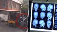 Bengaluru Shocker: पेड़ की टहनी गिरने से बाइक सवार की खोपड़ी पर 12 चोटें आने से मौत, दुखद वीडियो आया सामने