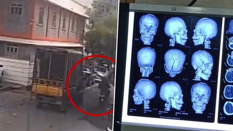 Bengaluru Shocker: पेड़ की टहनी गिरने से बाइक सवार की खोपड़ी पर 12 चोटें आने से मौत, दुखद वीडियो आया सामने