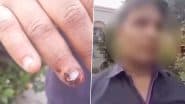 Aligarh Shocker: पत्नी के साबुन से नहाना पति को पड़ा महंगा! पुलिस ने चौकी में बंद कर जमकर की पिटाई, शख्स ने लगाया आरोप, अलीगढ़ से चौंकानेवाली घटना आई सामने (Watch Video)