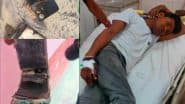 इमरजेंसी वार्ड में मरीज की जेब में अचानक धमाके के साथ फटा मोबाइल, अस्पताल में मचा हड़कंप