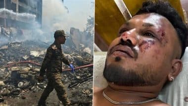 Ahmedabad Plane Crash: मेरे चारों ओर लाशें और और फ्लाइट के टुकड़े थे... इकलौते जिंदा बचे यात्री विश्वास कुमार ने क्या कहा?