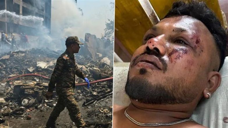 Ahmedabad Plane Crash: मेरे चारों ओर लाशें और और फ्लाइट के टुकड़े थे... इकलौते जिंदा बचे यात्री विश्वास कुमार ने क्या कहा?