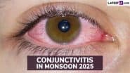 Conjunctivitis in Monsoon 2025: मानसून में आंखों में लाली या गुलाबीपन! कंजंक्टिवाइटिस हो सकता है! जानें क्या हैं इसके लक्षण और प्राथमिक उपचार!
