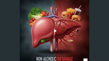 Health is Wealth: बिना शराब पिए भी खराब हो सकता है आपका लिवर! इन 4 आदतों को तुरंत सुधार लें, बच जाएगी जिंदगी