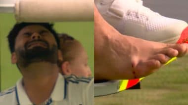 IND vs ENG 4th Test 2025: क्या ऋषभ पंत जैसे मामलों में चोटिल खिलाड़ियों के लिए रिप्लेसमेंट की अनुमति देगा ICC? जानिए क्या है पूरा मामला IND vs ENG 4th Test 2025: क्या ऋषभ पंत जैसे मामलों में चोटिल खिलाड़ियों के लिए रिप्लेसमेंट की अनुमति देगा ICC? जानिए क्या है पूरा मामला