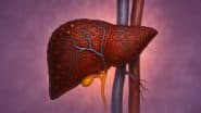 Fatty Liver Prevention Tips: लंबे समय तक बैठना पड़ सकता है भारी, फैटी लिवर के हो सकते हैं शिकार, जानें कैसे बचे?