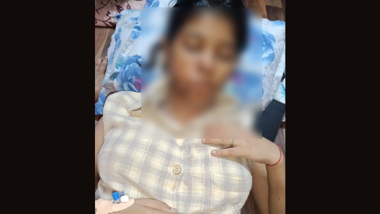 Kanpur Dog Attack: बीबीए की स्टूडेंट पर आवारा कुत्तों ने किया जानलेवा हमला, लगे 17 टांके,  छात्रा हॉस्पिटल में एडमिट, भयावह तस्वीरें आई सामने