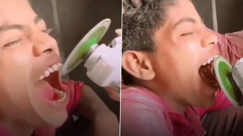 Viral Jugaad: शख्स ने टाइल मशीन से घिसे दोस्त के दांत, वीडियो देख हर कोई हैरान