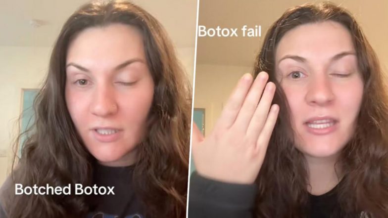 Botox Treatment Fail: बोटॉक्स ट्रीटमेंट कराना पड़ा भारी, महिला की आंख की पलकें गिरीं- देखें वायरल वीडियो