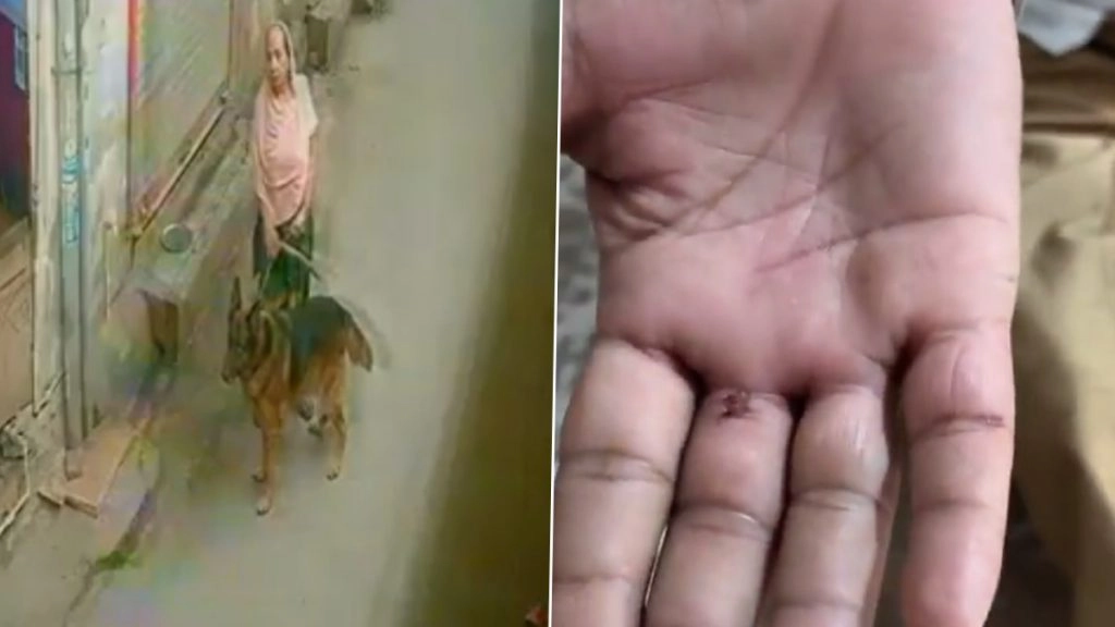 नोएडा जिले के गांव में बुजुर्ग पर पालतू कुत्ते ने किया हमला.
