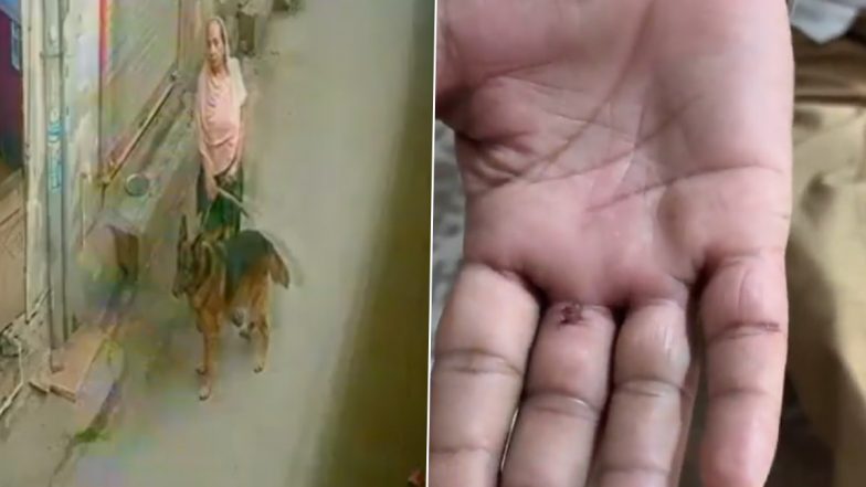 Dog Attack: दो कुत्तों की लड़ाई रोकने गए बुजुर्ग पर पालतू कुत्ते ने किया हमला, घायल हुआ शख्स, नोएडा के गिझोड़ गांव का वीडियो आया सामने; VIDEO
