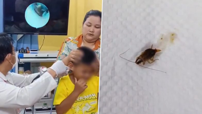 Viral Video: कंबोडिया में लड़के के कान से निकला जिंदा कॉकरोच, देखने वालों के उड़े होश