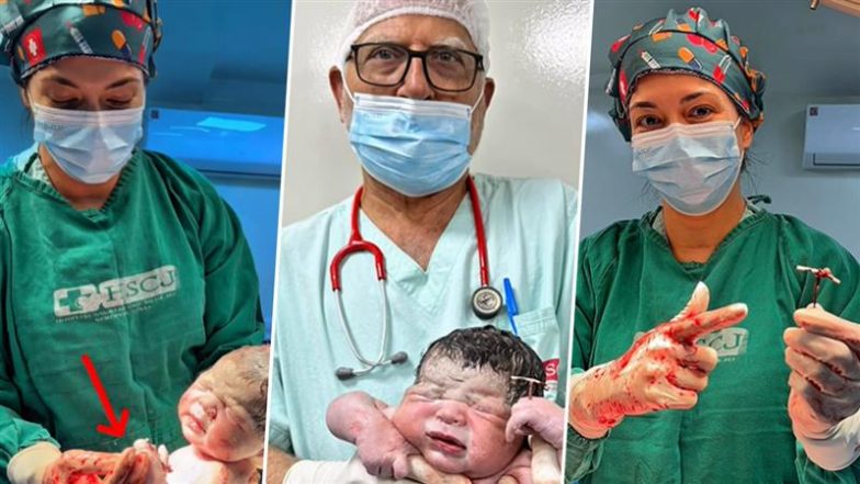 Brazil Viral Video: ब्राज़ील में नवजात शिशु ने जन्म के बाद पकड़ा आईयूडी, मां के गर्भनिरोधक उपाय को किया फेल