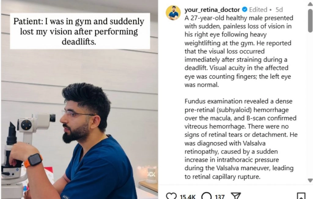 VIDEO: जिम में भारी वजन उठाने के बाद युवक की आंख से गई रोशनी