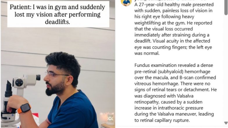 VIDEO: जिम में Heavy Lifting के बाद गई आंख की रोशनी, Valsalva Retinopathy बीमारी से पीड़ित हुआ युवक; डॉक्टर ने बताया Blindness का असली कारण